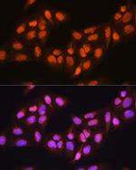 PRMT5 Antibody in Immunocytochemistry (ICC/IF)