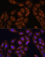 UPF1 Antibody in Immunocytochemistry (ICC/IF)