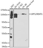 UPF1 Antibody in Western Blot (WB)