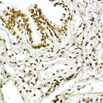 H4K5ac Antibody in Immunohistochemistry (Paraffin) (IHC (P))