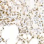 H4K5ac Antibody in Immunohistochemistry (Paraffin) (IHC (P))