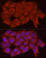 Caspase 7 p11 Antibody in Immunocytochemistry (ICC/IF)