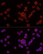 Caspase 7 p11 Antibody in Immunocytochemistry (ICC/IF)