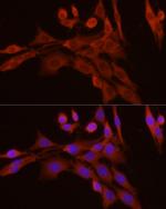 Caspase 7 p11 Antibody in Immunocytochemistry (ICC/IF)