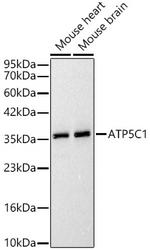 ATP Synthase gamma Antibody in Western Blot (WB)