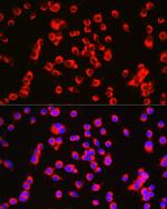 Catenin alpha-1 Antibody in Immunocytochemistry (ICC/IF)