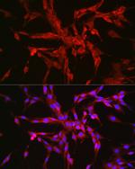 Catenin alpha-1 Antibody in Immunocytochemistry (ICC/IF)