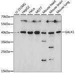 GALK1 Antibody in Western Blot (WB)