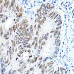 FOXA1 Antibody in Immunohistochemistry (Paraffin) (IHC (P))