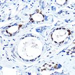 FOXA1 Antibody in Immunohistochemistry (Paraffin) (IHC (P))