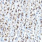 FOXA1 Antibody in Immunohistochemistry (Paraffin) (IHC (P))