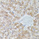 IVD Antibody in Immunohistochemistry (Paraffin) (IHC (P))