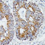 IVD Antibody in Immunohistochemistry (Paraffin) (IHC (P))