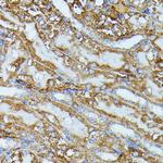 IVD Antibody in Immunohistochemistry (Paraffin) (IHC (P))