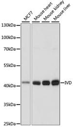 IVD Antibody in Western Blot (WB)