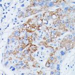 MANBA Antibody in Immunohistochemistry (Paraffin) (IHC (P))