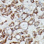 MANBA Antibody in Immunohistochemistry (Paraffin) (IHC (P))