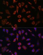 Cytohesin 1 Antibody in Immunocytochemistry (ICC/IF)