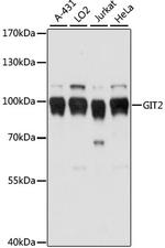 GIT2 Antibody in Western Blot (WB)