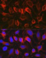 G6PD Antibody in Immunocytochemistry (ICC/IF)