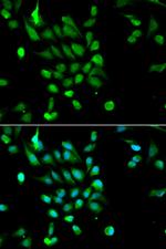 PSMC5 Antibody in Immunocytochemistry (ICC/IF)