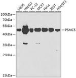 PSMC5 Antibody in Western Blot (WB)