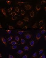 TCIRG1 Antibody in Immunocytochemistry (ICC/IF)