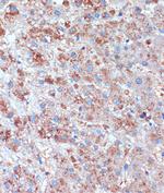 TCIRG1 Antibody in Immunohistochemistry (Paraffin) (IHC (P))