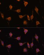 VAV3 Antibody in Immunocytochemistry (ICC/IF)