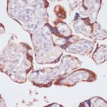 NFATC1 Antibody in Immunohistochemistry (Paraffin) (IHC (P))