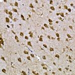 CPEB3 Antibody in Immunohistochemistry (Paraffin) (IHC (P))