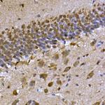 CPEB3 Antibody in Immunohistochemistry (Paraffin) (IHC (P))