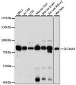 SLC44A1 Antibody in Western Blot (WB)