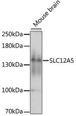 KCC2 Antibody in Western Blot (WB)