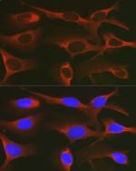 WNK3 Antibody in Immunocytochemistry (ICC/IF)