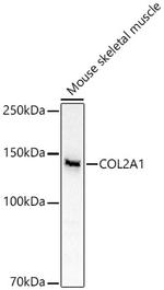 Collagen II Antibody in Western Blot (WB)