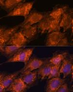 Importin 4 Antibody in Immunocytochemistry (ICC/IF)