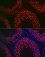 DDX4 Antibody in Immunohistochemistry (Paraffin) (IHC (P))