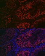 DDX4 Antibody in Immunohistochemistry (Paraffin) (IHC (P))