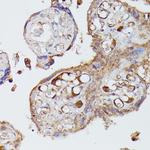 Angiotensinogen Antibody in Immunohistochemistry (Paraffin) (IHC (P))