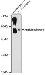 Angiotensinogen Antibody in Western Blot (WB)