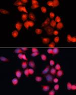 SLC25A5 Antibody in Immunocytochemistry (ICC/IF)