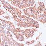 Cdc20 Antibody in Immunohistochemistry (Paraffin) (IHC (P))