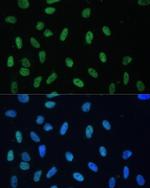 hnRNP D Antibody in Immunocytochemistry (ICC/IF)