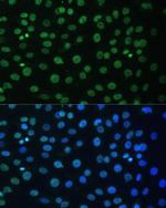 hnRNP D Antibody in Immunocytochemistry (ICC/IF)