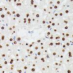 hnRNP D Antibody in Immunohistochemistry (Paraffin) (IHC (P))