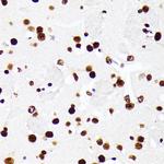 hnRNP D Antibody in Immunohistochemistry (Paraffin) (IHC (P))