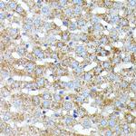 Haptoglobin Antibody in Immunohistochemistry (Paraffin) (IHC (P))