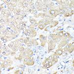 Haptoglobin Antibody in Immunohistochemistry (Paraffin) (IHC (P))