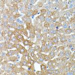 Haptoglobin Antibody in Immunohistochemistry (Paraffin) (IHC (P))